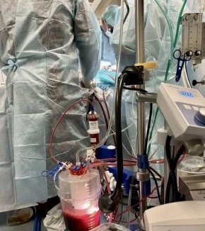 Калужские медики спасли жизнь, опробовав новую технологию